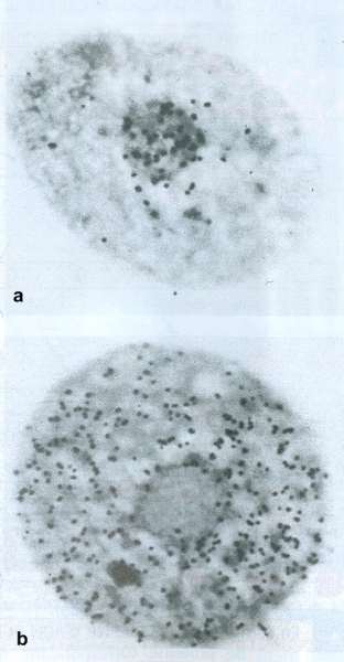 Injection uridine tritiée